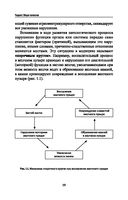 Основы патологии — фото, картинка — 19