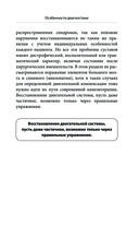 Боли в плече, или Как вернуть подвижность рукам — фото, картинка — 21
