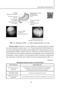 Наглядная детская гастроэнтерология и гепатология — фото, картинка — 13