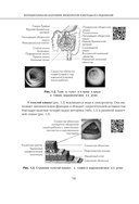 Наглядная детская гастроэнтерология и гепатология — фото, картинка — 14