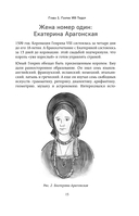 Ревматология в лицах. Как болезни меняли судьбы великих — фото, картинка — 15