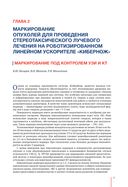 Рекомендации по проведению стереотаксической лучевой терапии на аппарате 