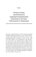 Эндопротезирование коленного сустава: ответы практикующего врача на все вопросы пациентов — фото, картинка — 11