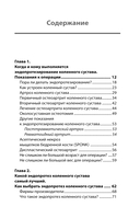Эндопротезирование коленного сустава: ответы практикующего врача на все вопросы пациентов — фото, картинка — 6